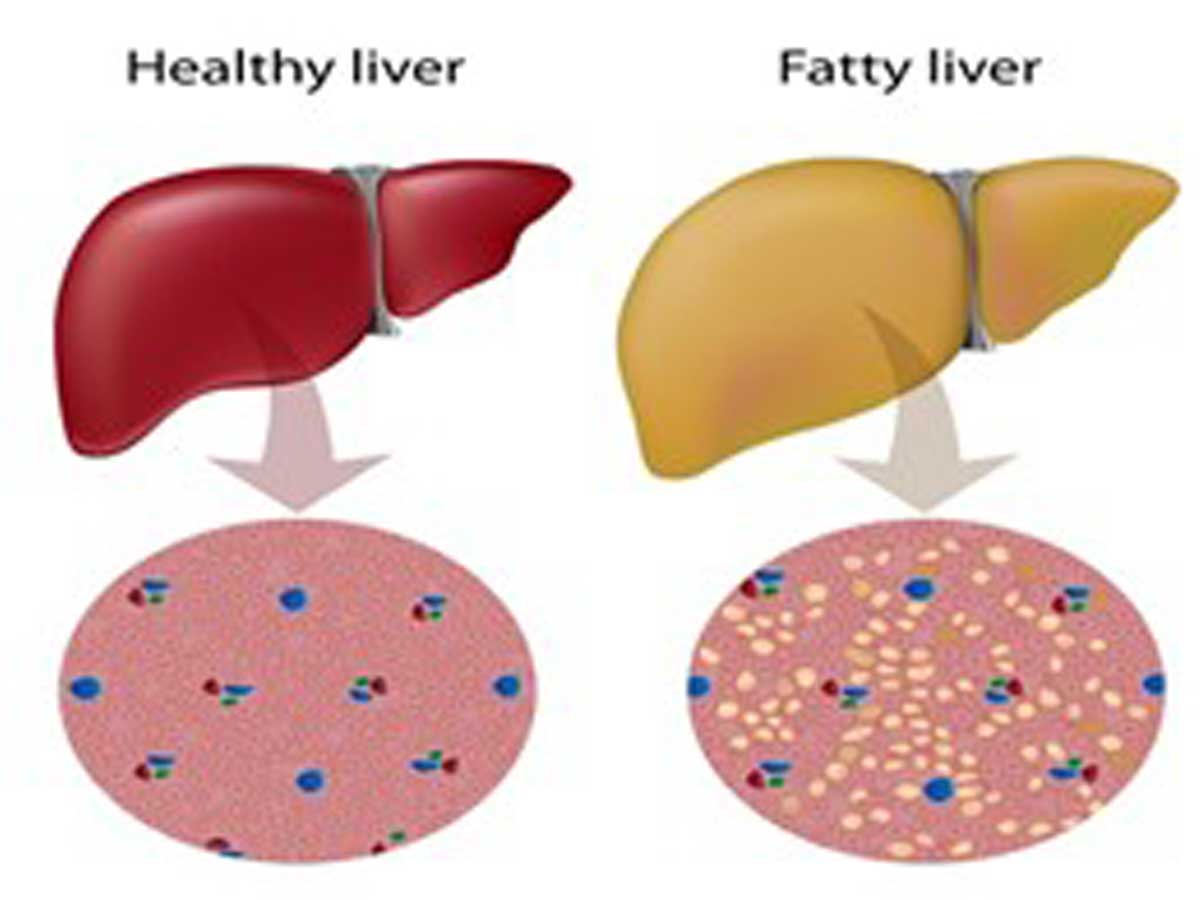 Lipid & Liver Panel! What are they?
